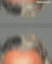 ekys